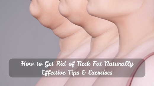 How to Get Rid of Neck Fat Naturally : Effective Tips & Exercises